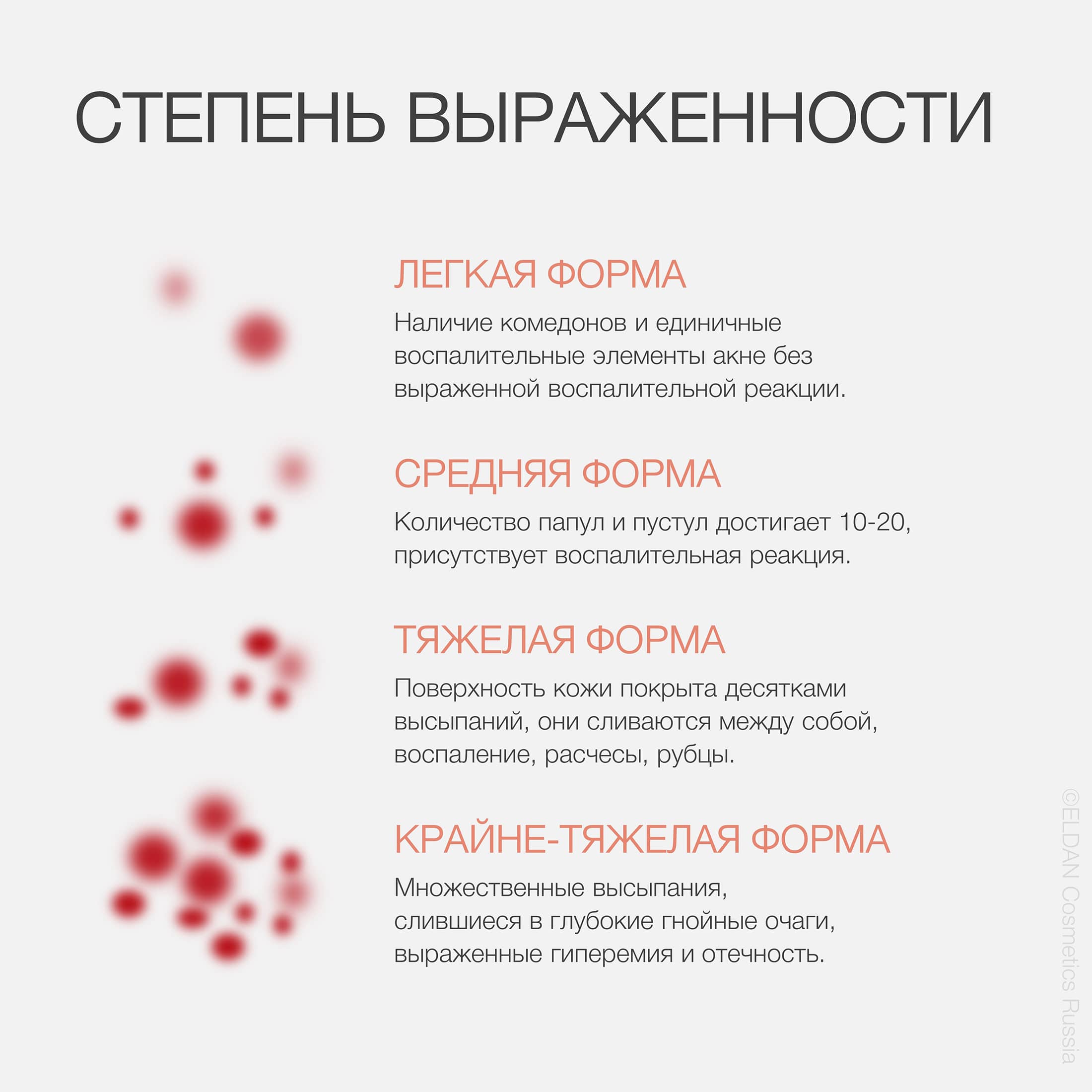 Пост виды акне 4.jpg